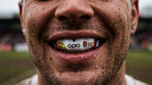 Why You Need a Gumshield in Rugby